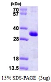 Human CSEN protein, His tag. GTX68453-pro