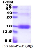 Human ZNRD1 protein, His tag. GTX68454-pro