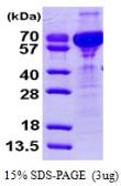 Human CRNN protein, His tag. GTX68456-pro