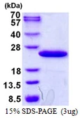 Human TPRKB protein, His tag. GTX68461-pro