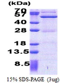 Human ASCC1 protein, His tag. GTX68462-pro