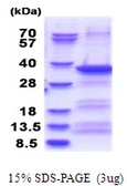 Human EXOSC3 protein, His tag. GTX68463-pro