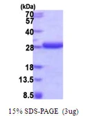 Human HDDC2 protein, His tag. GTX68465-pro
