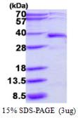 Human DERA protein, His tag. GTX68469-pro