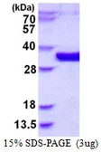 Human MEMO1 protein, His tag. GTX68470-pro