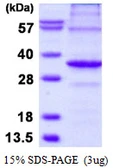Human APIP protein, His tag. GTX68471-pro