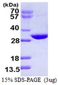 Human CUTC protein, His tag. GTX68472-pro