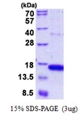 Human GOLGA7 protein, His tag. GTX68478-pro