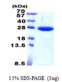 Human SAR1B protein, His tag. GTX68479-pro
