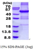 Human PHF11 protein, His tag. GTX68480-pro