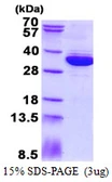 Human MRTO4 protein, His tag. GTX68481-pro