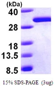 Human DCXR protein, His tag. GTX68485-pro