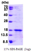 Human GLRX5 protein, His tag. GTX68487-pro