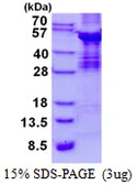 Human ABI3 protein, His tag. GTX68488-pro