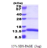 Human PACAP protein, His tag. GTX68491-pro