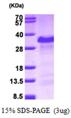 Human PAIP2 protein, His tag. GTX68492-pro
