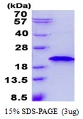 Human RNF181 protein, His tag. GTX68494-pro