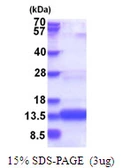 Human CHCHD8 protein, His tag. GTX68498-pro