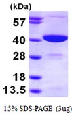 Human GMPR2 protein, His tag. GTX68499-pro