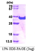 Human SPG21 protein, His tag. GTX68501-pro