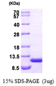Human AHSP protein. GTX68502-pro