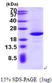 Human NIP7 protein, His tag. GTX68503-pro