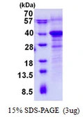 Human RWDD1 protein, His tag. GTX68504-pro