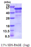 Human IP6K2 protein, His tag. GTX68507-pro