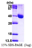 Human LCMT1 protein, His tag. GTX68508-pro