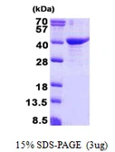 Human GULP1 protein, His tag. GTX68509-pro