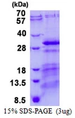 Human CHMP5 protein, His tag. GTX68513-pro