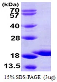 Human GSKIP protein, His tag. GTX68514-pro
