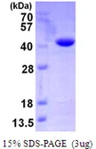 Human VTA1 protein, His tag. GTX68515-pro