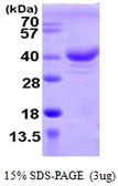 Human ZCCHC17 protein, His tag. GTX68516-pro