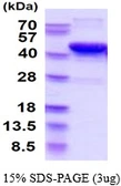 Human SIRT6 protein, His tag. GTX68517-pro