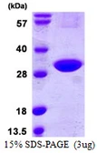 Human CINP protein, His tag. GTX68518-pro