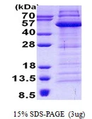 Human EAPII protein, His tag. GTX68522-pro