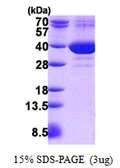 Human FAM49B protein, His tag. GTX68523-pro