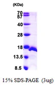 Human SF3B14 protein, His tag. GTX68526-pro