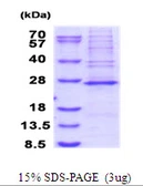 Human MRPS23 protein, His tag. GTX68527-pro