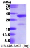 Human VPS24 protein, His tag. GTX68528-pro