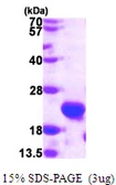 Human C1orf41 protein, His tag. GTX68529-pro