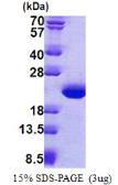 Human TPPP3 protein, His tag. GTX68530-pro