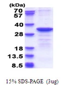 Human CYB5R2 protein, His tag. GTX68533-pro
