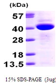 Human CAB39 protein, His tag. GTX68534-pro