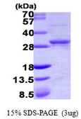Human CMPK1 protein, His tag. GTX68535-pro