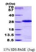 Human SP17 protein, His tag. GTX68539-pro