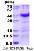 Human MBD3 protein, His tag. GTX68540-pro