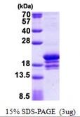 Human DNA polymerase epsilon 3 protein, His tag. GTX68542-pro