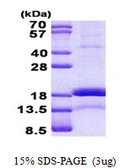 Human CHRAC1 protein, His tag. GTX68543-pro